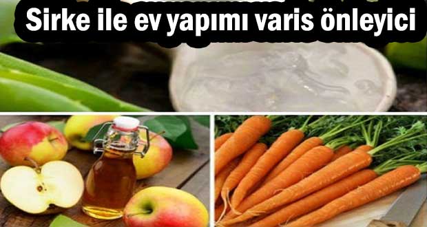 sirke_ile_ev_yapimi_varis_onleyici.jpg