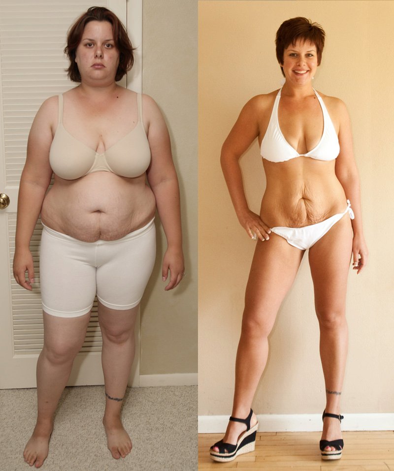 before-after-weight-loss-12.jpg