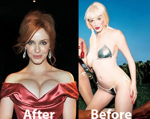 christina-hendricks-breast-implant.webp