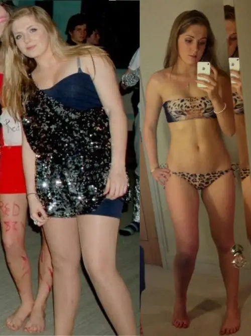 girl-weight-loss.webp