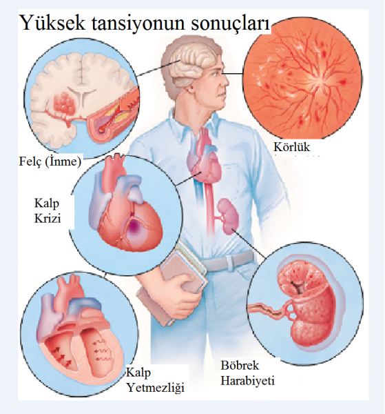 hipertansiyonun-sonuc3a7larc4b11.png