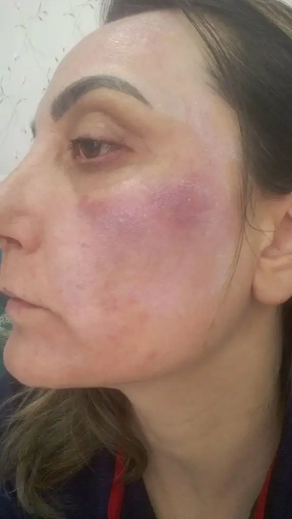 IMG-20190516-WA0036.webp