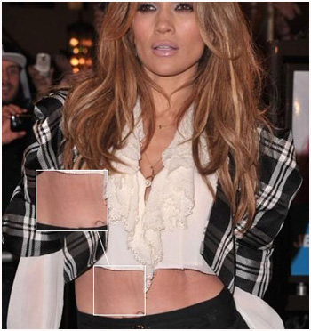 Jennifer-Lopez-belly-stretch-marks.jpg