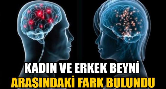 kadin_ve_erkek_beyni_arasindaki_fark_bulundu_h26156.jpg