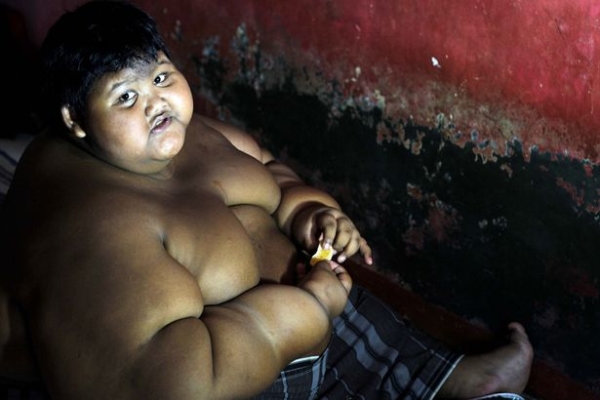 pay-arya-permana-worlds-fattest-child_10704489085774fc1a339b2.jpg