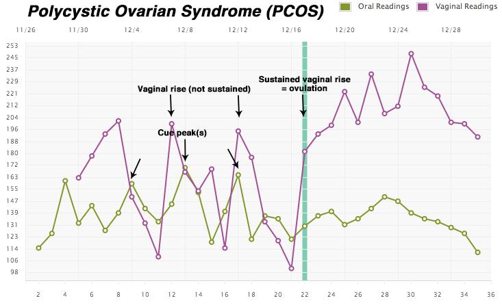 PCOS.jpg