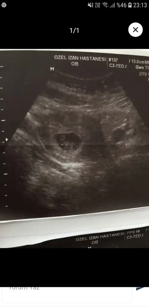 Screenshot_20190414-231329_She Pregnant.webp