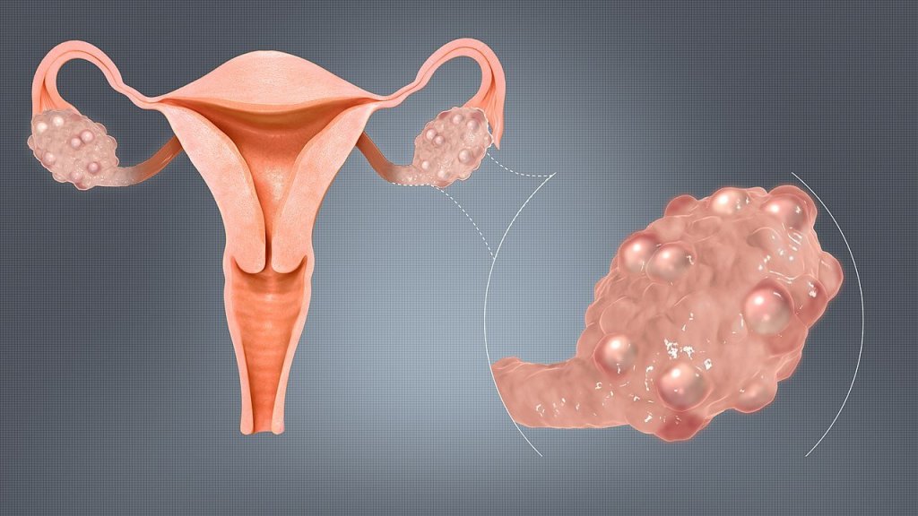 subfertilite nedir, ne demek