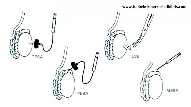 tesa-tese-konusuna resim.jpg