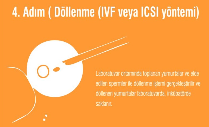 tup_bebek_4_asama_ivf.jpg