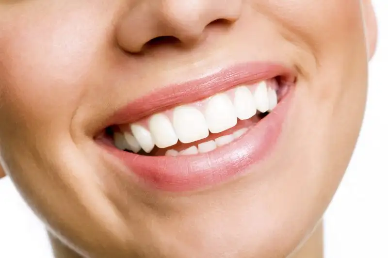 white-teeth.webp