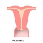 arkuat uterus.jpg