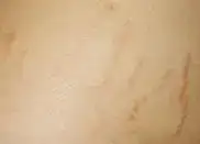 $n_276_m.webp