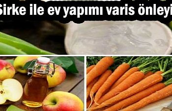 Varislere sirke havuç ve aleo vera jeli ile son !