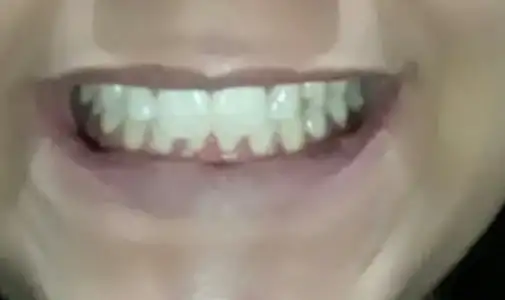 20180115_191414.webp