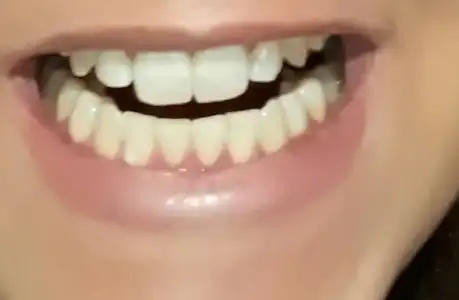 20180115_191443.webp