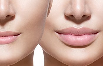 Dolgun Dudaklar İçin Maske Tarifi Dudak Kalınlaştırma Peeling