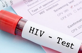 Anti HİV Non Reactive Ne Demek? Anti HIV Testi Sonucu