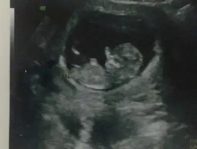 IMG-20190128-WA0002.webp