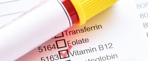 B12 Vitamini Eksikliği Tedavisi Nasıl Yapılır?
