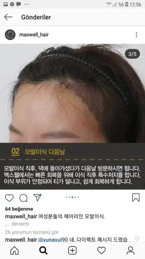 Screenshot_20190802-125608_Instagram.webp