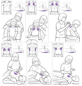 how-to-do-chest-percussions-to-help-your-child-drain-mucus-from-the-lungs-3.jpeg