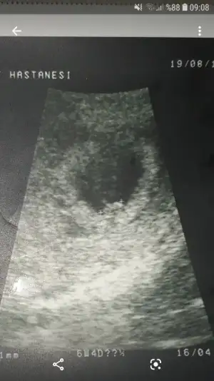 Screenshot_20191028-090810_Photos.webp