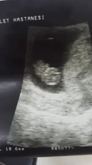 Screenshot_20191028-090820_Photos.webp