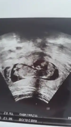 Screenshot_20191028-090914_Photos.webp