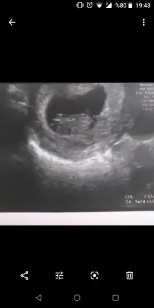 Screenshot_20191209-194319.webp