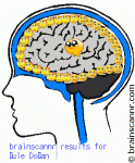 $brainscannr.gif