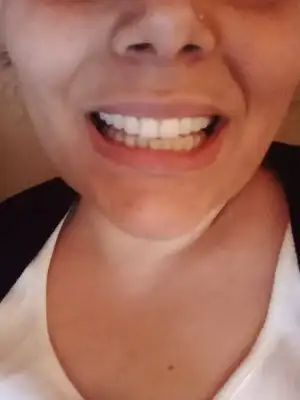 diş.webp