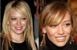 $hilary-duff-teeth-before-and-after.jpg