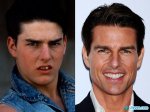 $tom-cruise-before-after1.jpg