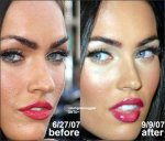 $megan-fox-nose-job0.jpg