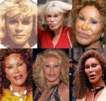 $Jocelyn Wildenstein B & A.img_assist_custom.jpg