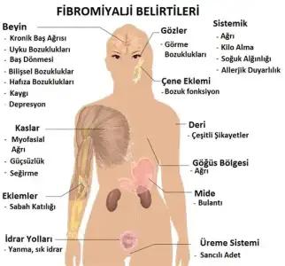fibromiyalji-semptomlar.webp
