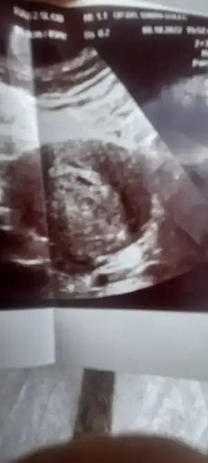 Screenshot_20221012-154229_Gallery.webp