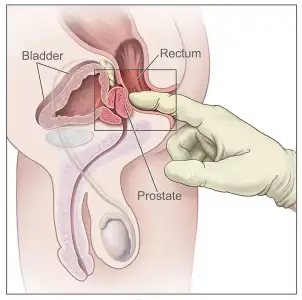 Digital-Rectal-Examination-Rectal-Anatomy.webp