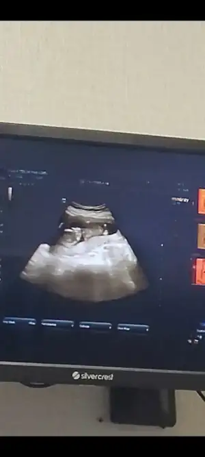 Screenshot_20221119-145702_Photos.webp