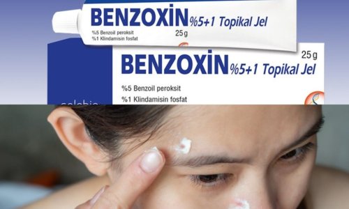 Benzoxin Krem Nedir, Ne İşe Yarar, Nasıl Kullanılır?