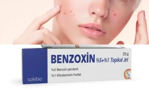 Benzoxin_krem_sivilceye_iyi_Gelir_mi.webp