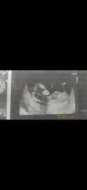 Screenshot_20230823-020436_Gallery.webp
