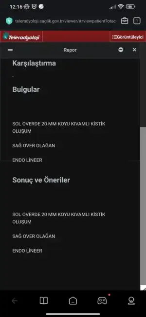 Screenshot_2023-11-30-12-16-14-089_com.mi.globalbrowser.webp