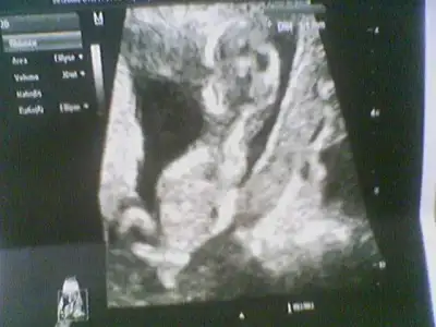 $020820123043.webp