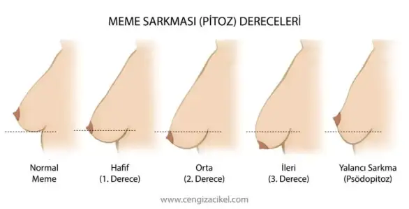 meme-diklestirme-1 (1).webp