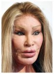 $CelebrityPlasticSurgeryGoneWrong.jpg