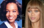 $Tyra-Banks_nariz-nosejob_www_antesydespues_com_ar.jpg