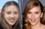 $Scarlett-Johansson_nariz-nosejob_www_antesydespues_com_ar.jpg