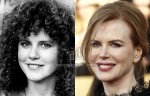 $Nicole-Kidman_nariz-nosejob_www_antesydespues_com_ar.jpg